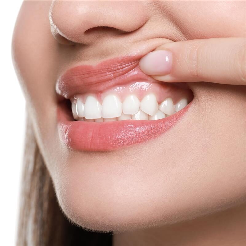 Woman showing gums for Non-Surgical Gum Recession Treatment in Arcadia, Phoenix.
