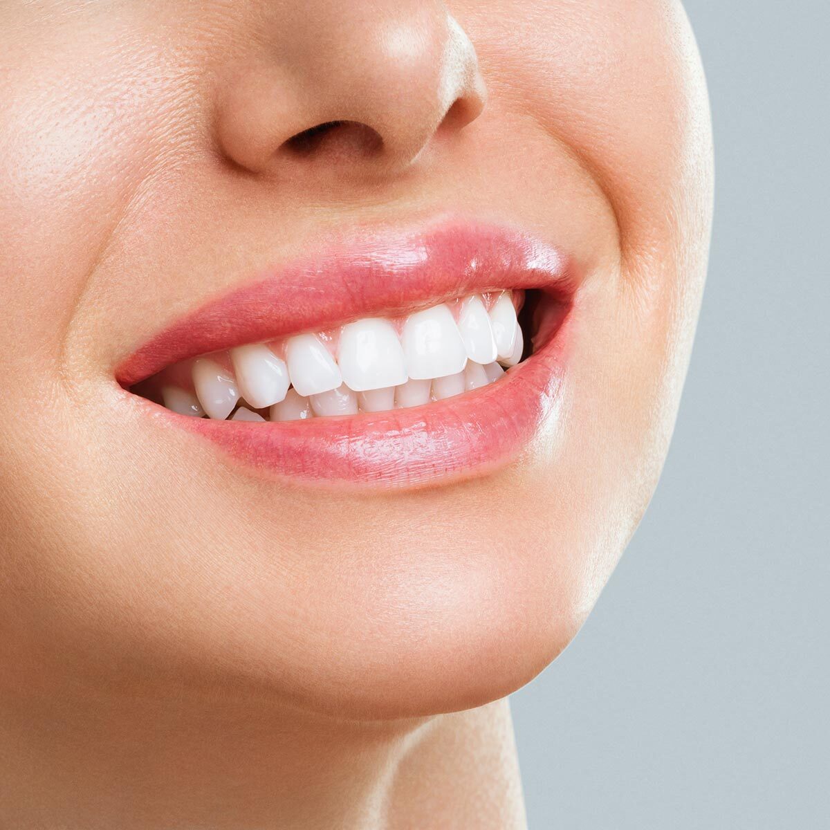 Close-up of bright white smile — professional teeth whitening in Arcadia, Phoenix.